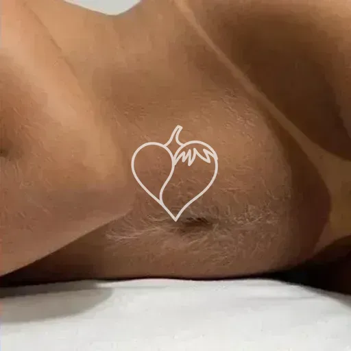 Alana
