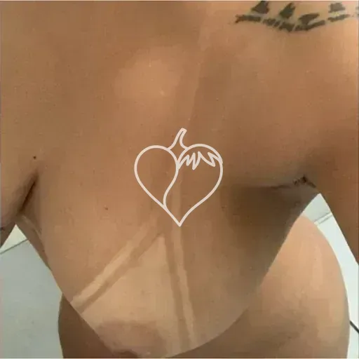 Ana
